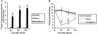 Acute Mono-Arthritis Activates the Neurohypophysial System and Hypothalamo-Pituitary Adrenal Axis in Rats